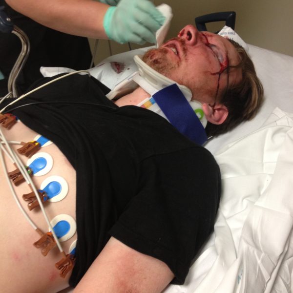Photo of Nathan being worked on in the emergency room