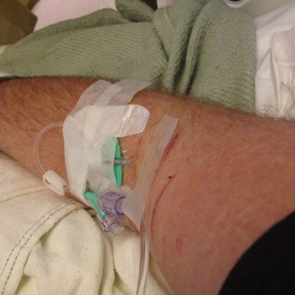 Nathan’s IV during his hospital visit
